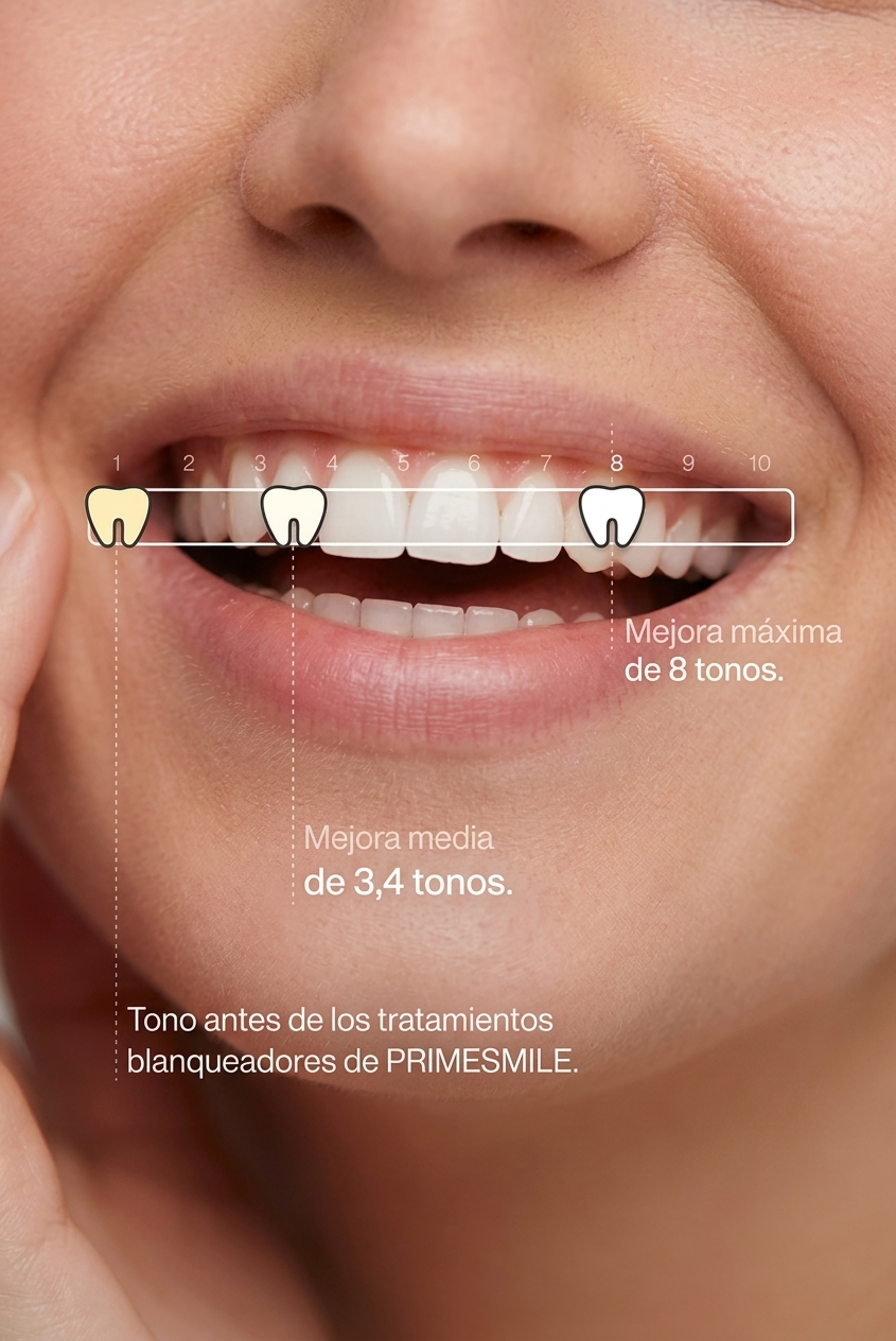PURPLE V34 - Blanqueador Dental